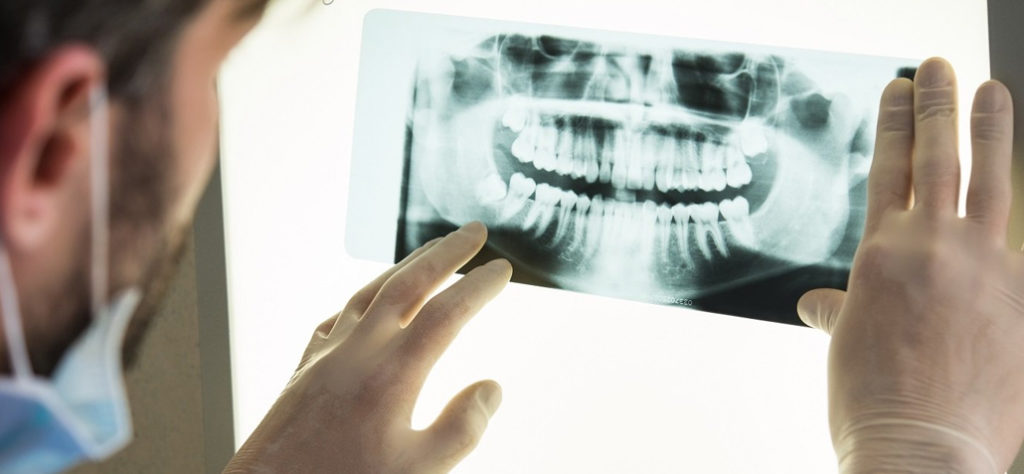 DENTALPLUS studio dentistico - Ortopantomografia: affidabilità ed efficacia nel valutare l’età